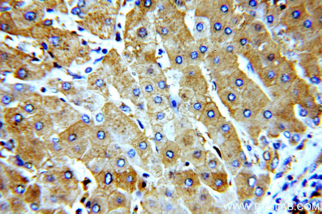 LTBR Antibody in Immunohistochemistry (Paraffin) (IHC (P))