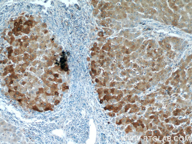 LTBR Antibody in Immunohistochemistry (Paraffin) (IHC (P))