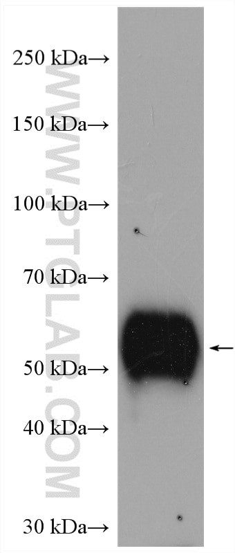 LTBR Antibody in Western Blot (WB)