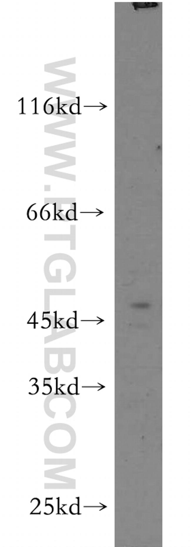 LTBR Antibody in Western Blot (WB)