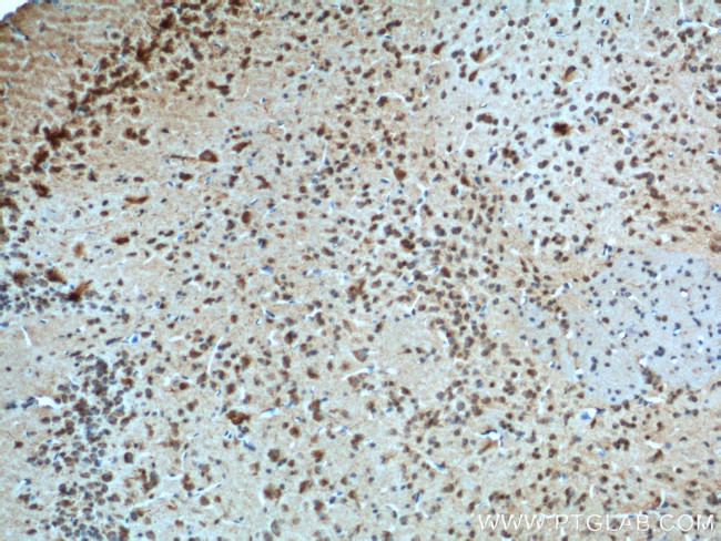 Adenosine A1 Receptor Antibody in Immunohistochemistry (Paraffin) (IHC (P))