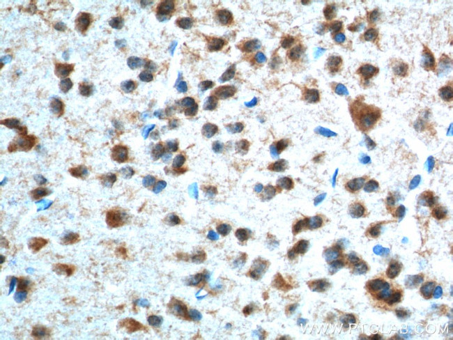 Adenosine A1 Receptor Antibody in Immunohistochemistry (Paraffin) (IHC (P))