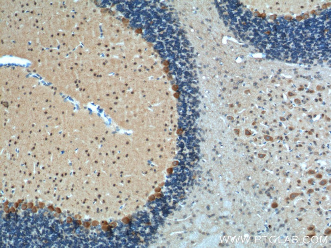 Adenosine A1 Receptor Antibody in Immunohistochemistry (Paraffin) (IHC (P))