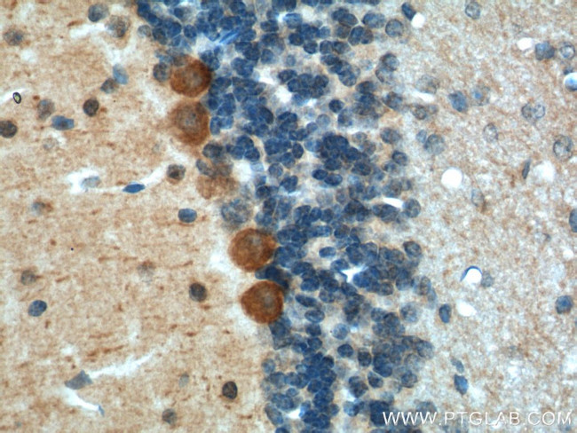 Adenosine A1 Receptor Antibody in Immunohistochemistry (Paraffin) (IHC (P))