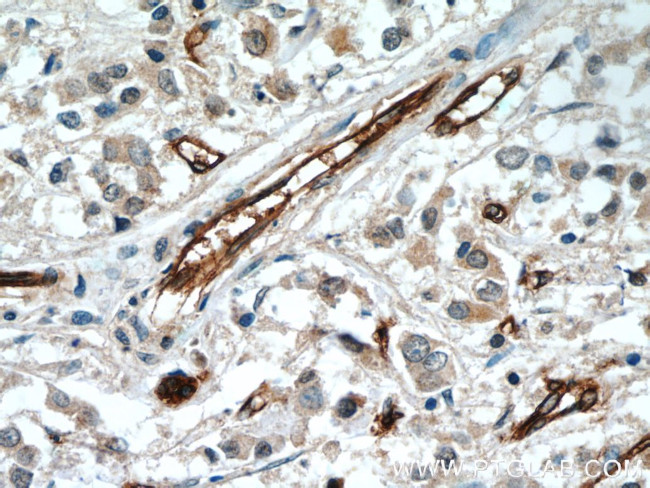 AQP1 Antibody in Immunohistochemistry (Paraffin) (IHC (P))