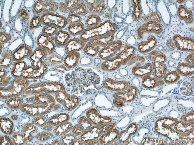 AQP1 Antibody in Immunohistochemistry (Paraffin) (IHC (P))