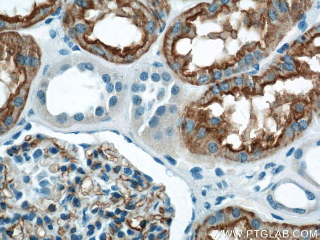 AQP1 Antibody in Immunohistochemistry (Paraffin) (IHC (P))