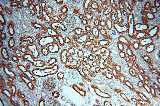 AQP1 Antibody in Immunohistochemistry (Paraffin) (IHC (P))