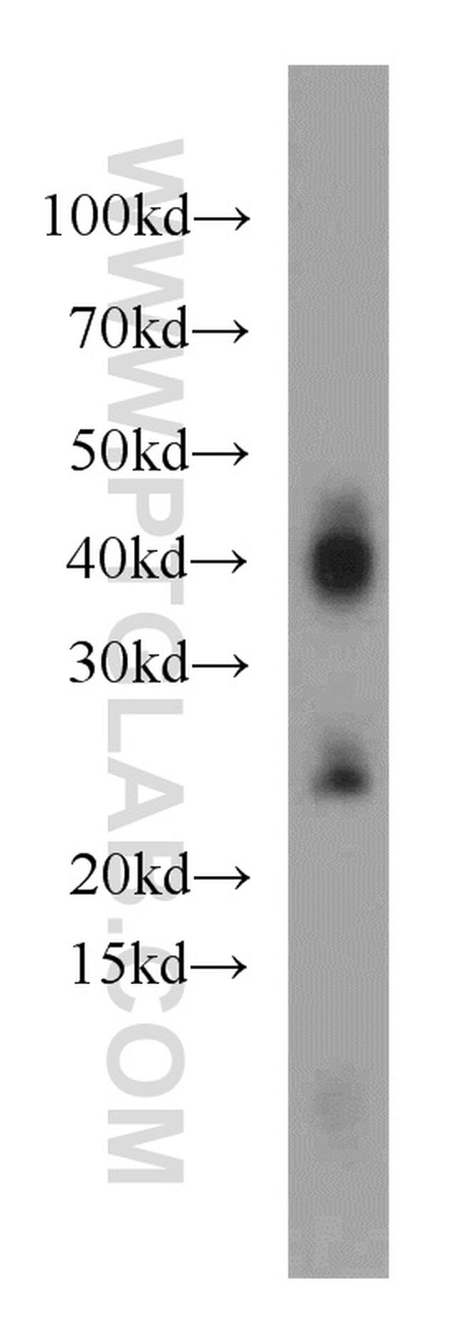 AQP1 Antibody in Western Blot (WB)