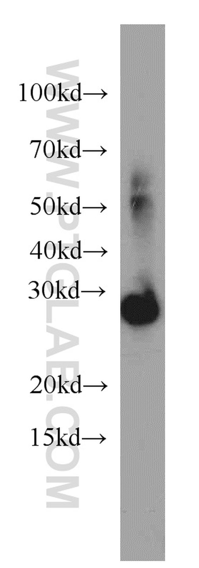 AQP1 Antibody in Western Blot (WB)
