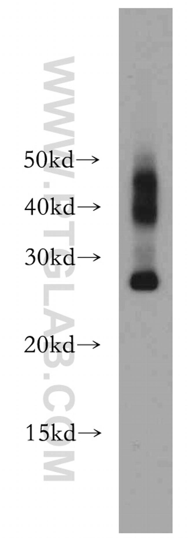 AQP1 Antibody in Western Blot (WB)