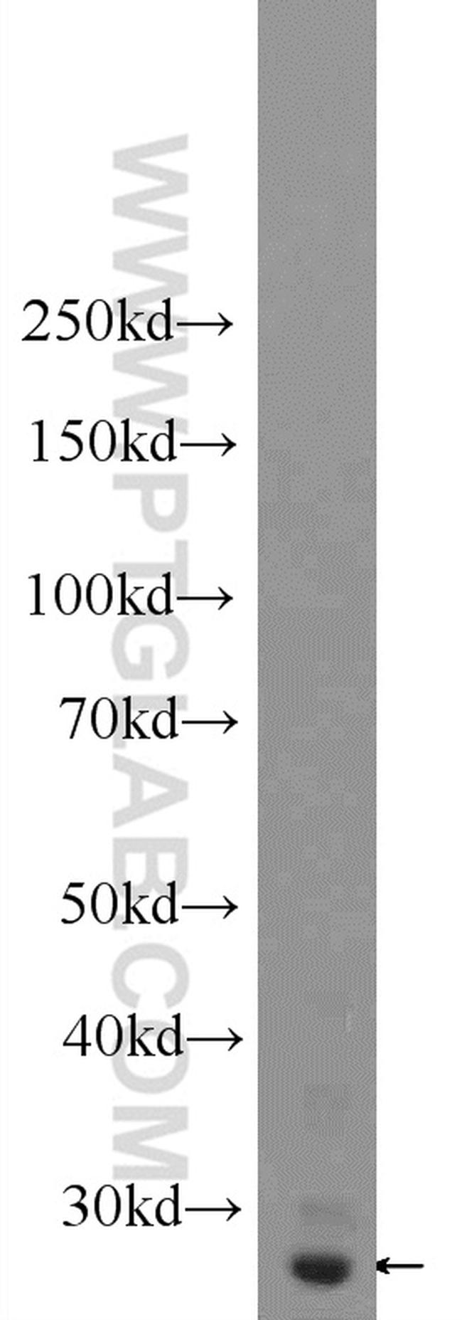 AQP1 Antibody in Western Blot (WB)