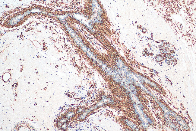 AQP1 Antibody in Immunohistochemistry (Paraffin) (IHC (P))