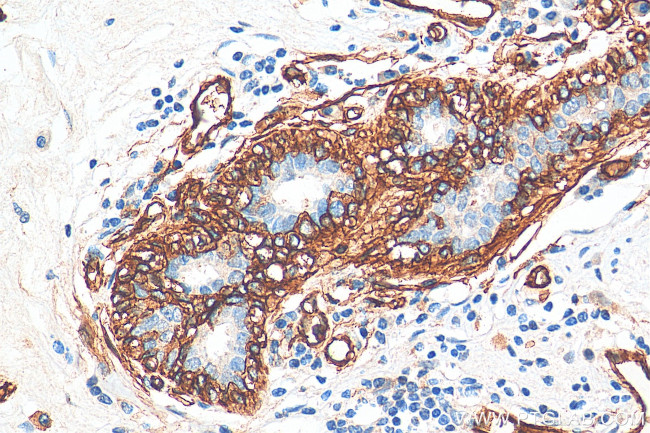 AQP1 Antibody in Immunohistochemistry (Paraffin) (IHC (P))