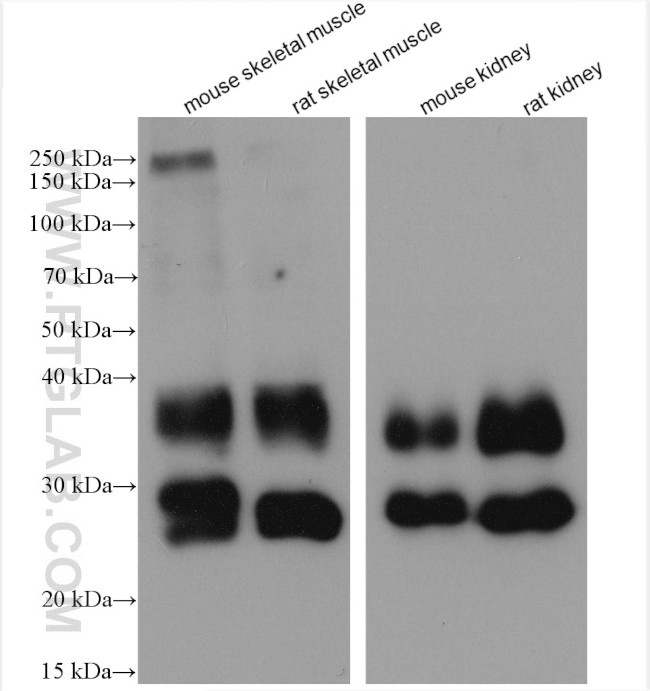 AQP1 Antibody in Western Blot (WB)