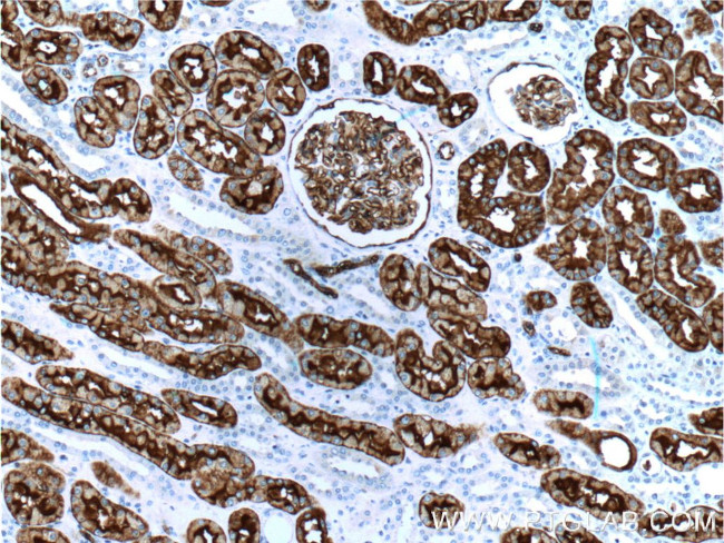 AQP1 Antibody in Immunohistochemistry (Paraffin) (IHC (P))