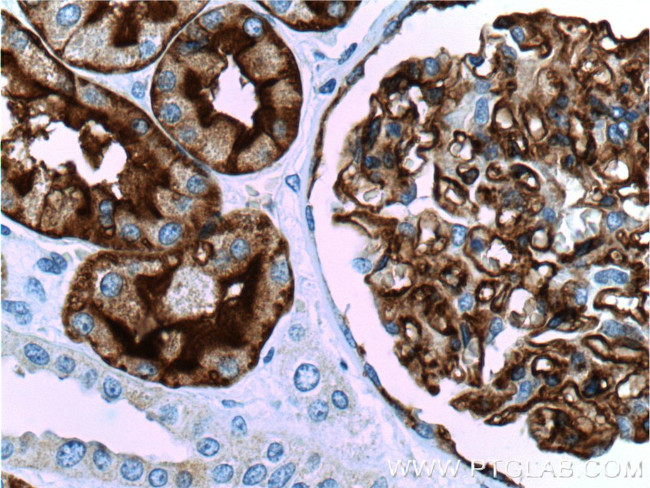 AQP1 Antibody in Immunohistochemistry (Paraffin) (IHC (P))