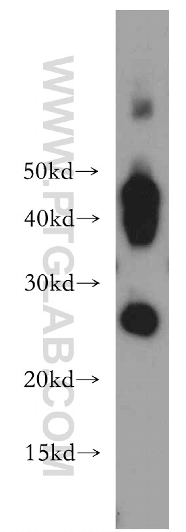 AQP1 Antibody in Western Blot (WB)