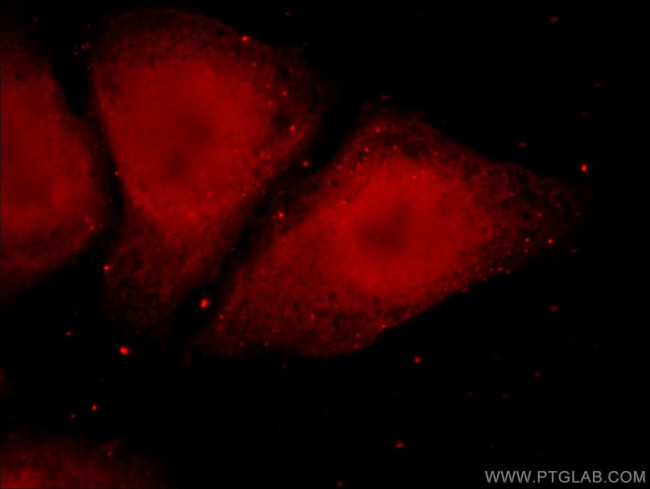 TADA1L Antibody in Immunocytochemistry (ICC/IF)