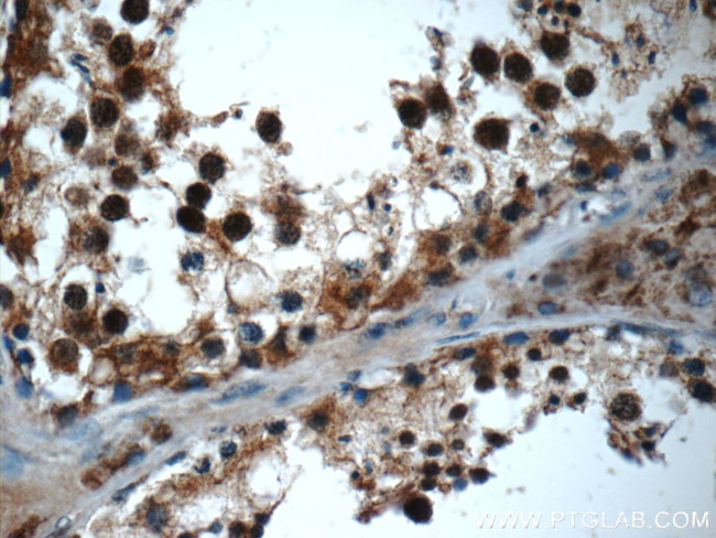 TADA1L Antibody in Immunohistochemistry (Paraffin) (IHC (P))