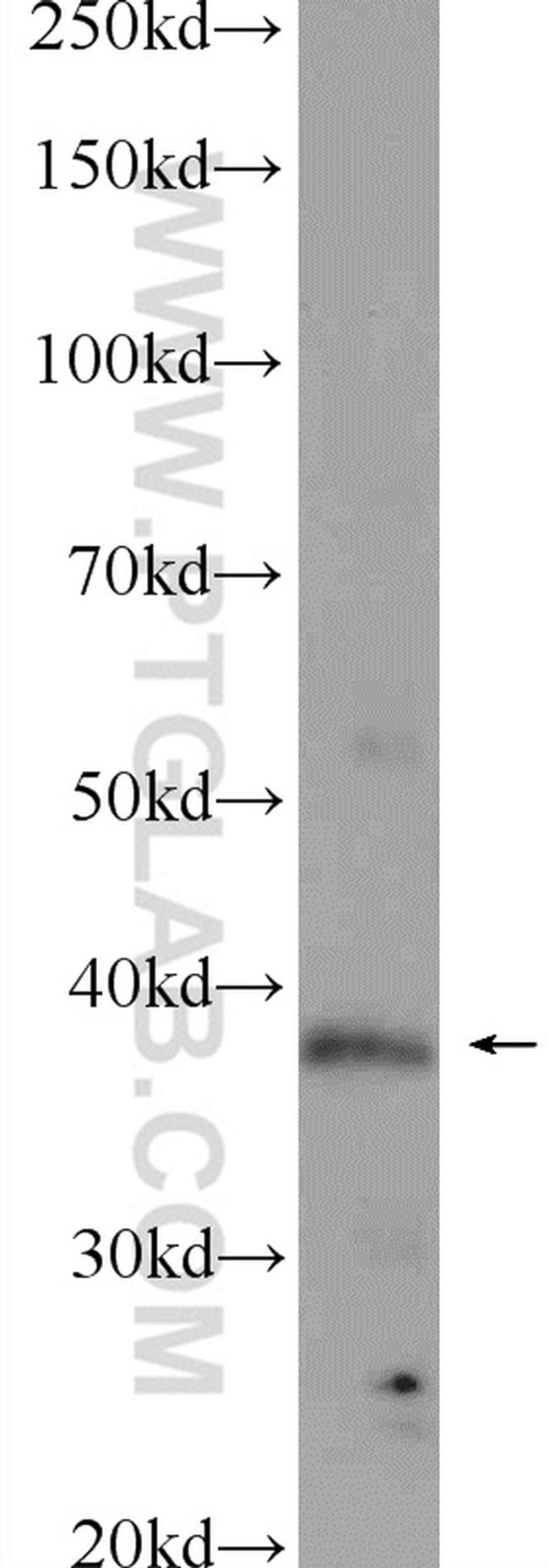 TADA1L Antibody in Western Blot (WB)