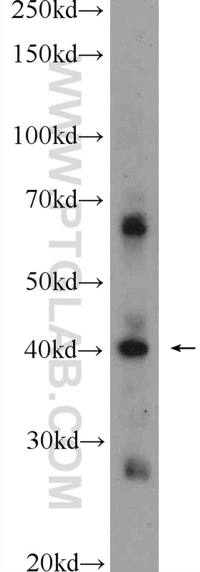 TADA1L Antibody in Western Blot (WB)