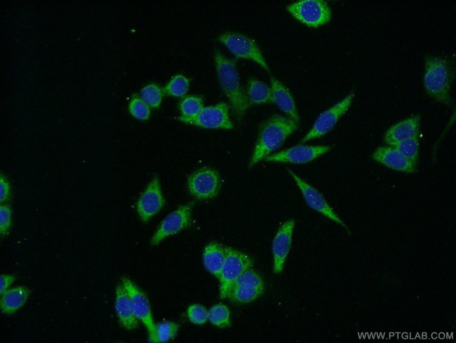 YBX1 Antibody in Immunocytochemistry (ICC/IF)