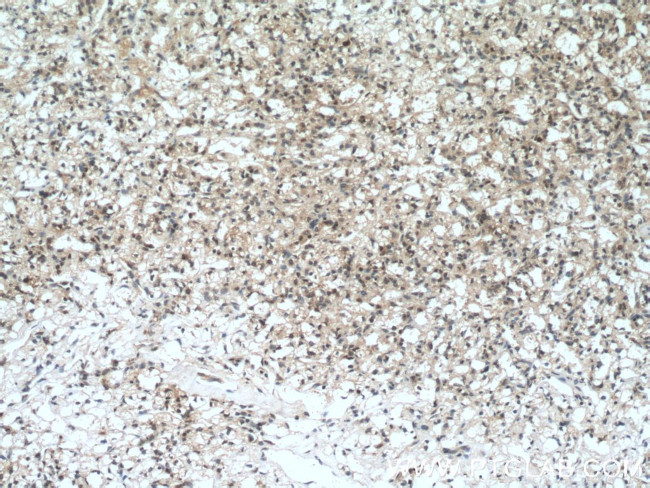 YBX1 Antibody in Immunohistochemistry (Paraffin) (IHC (P))