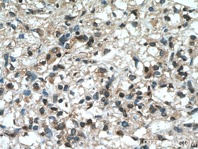 YBX1 Antibody in Immunohistochemistry (Paraffin) (IHC (P))