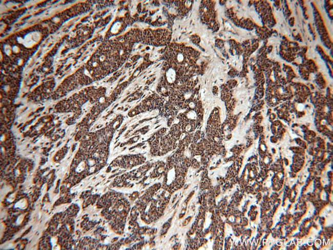 YBX1 Antibody in Immunohistochemistry (Paraffin) (IHC (P))