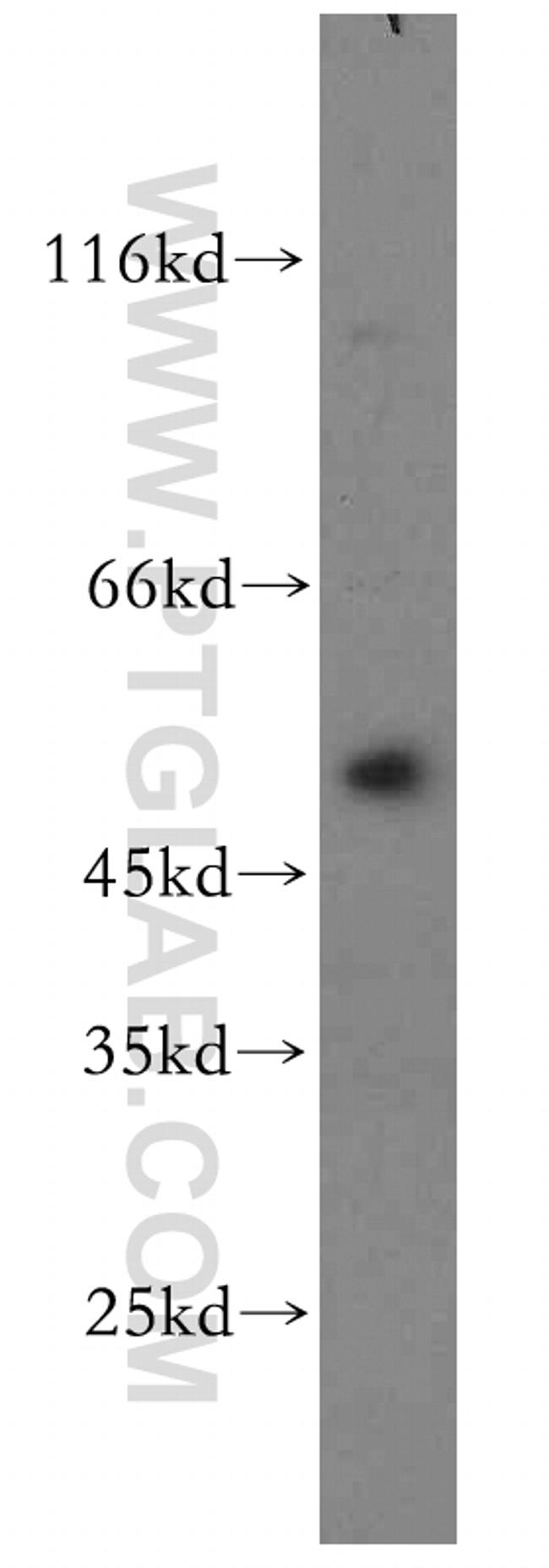 YBX1 Antibody in Western Blot (WB)