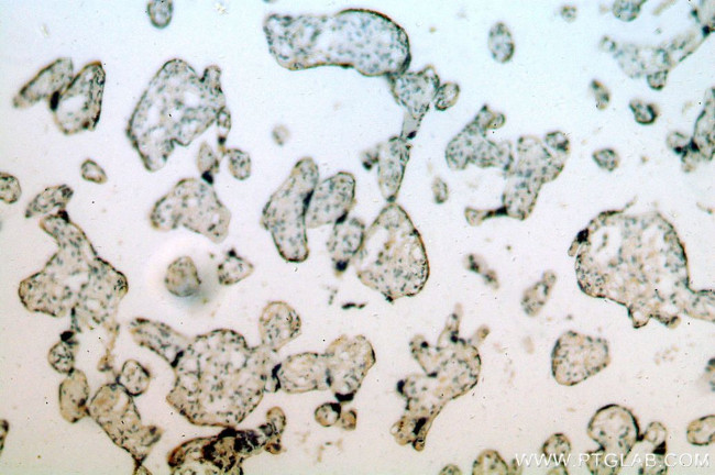 SLC18A1 Antibody in Immunohistochemistry (Paraffin) (IHC (P))