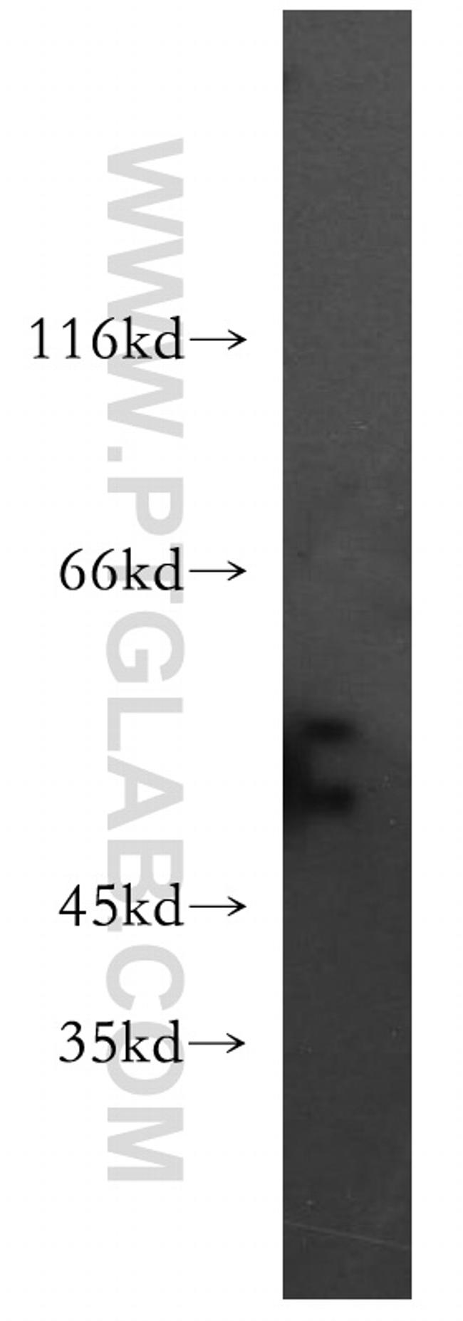 SLC18A1 Antibody in Western Blot (WB)