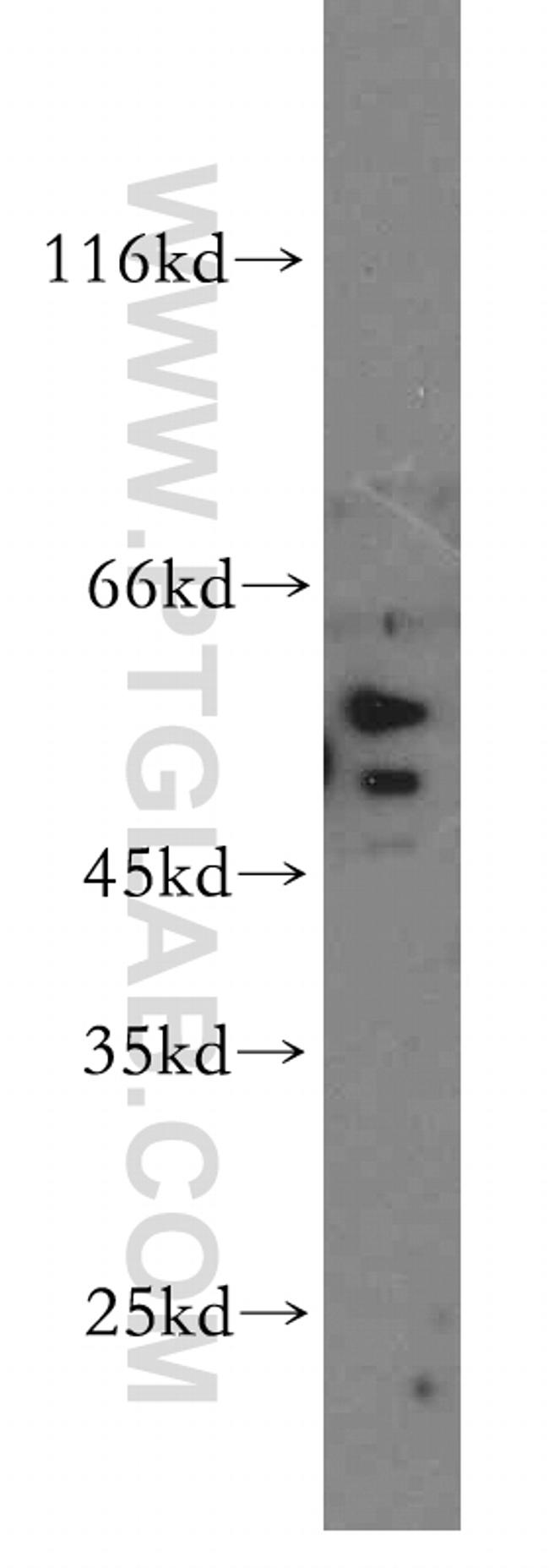 SLC18A1 Antibody in Western Blot (WB)