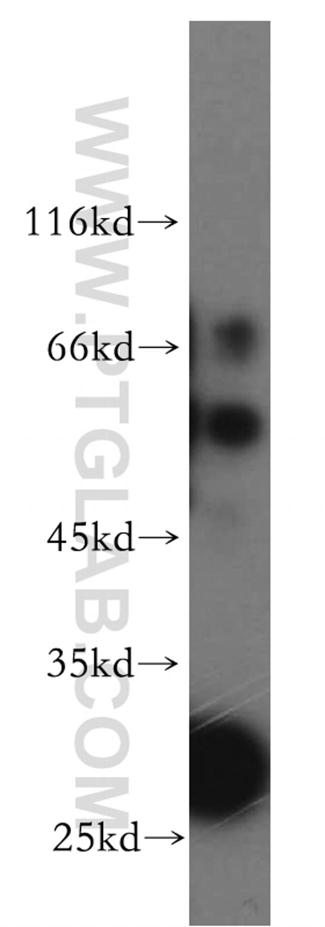 SLC18A1 Antibody in Western Blot (WB)