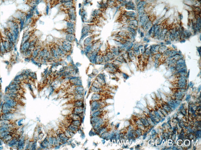 APJ Antibody in Immunohistochemistry (Paraffin) (IHC (P))