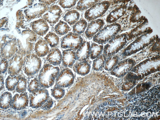 APJ Antibody in Immunohistochemistry (Paraffin) (IHC (P))