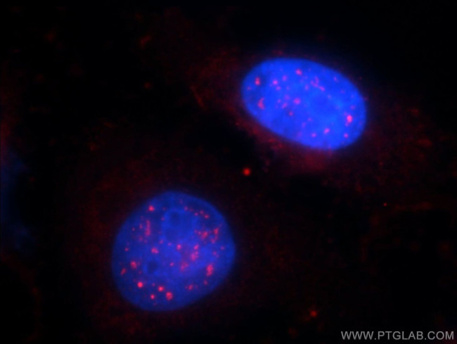 LASS2 Antibody in Immunocytochemistry (ICC/IF)