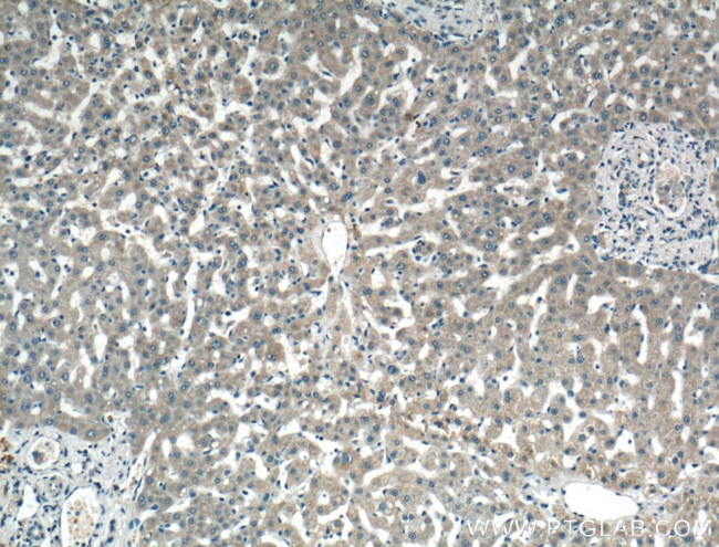 LASS2 Antibody in Immunohistochemistry (Paraffin) (IHC (P))