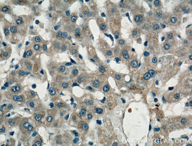 LASS2 Antibody in Immunohistochemistry (Paraffin) (IHC (P))