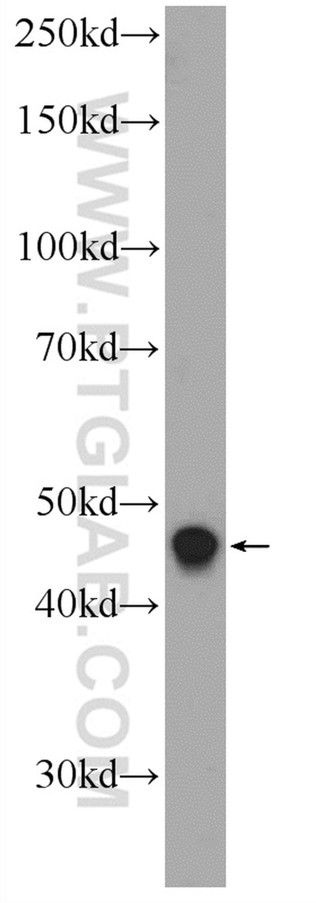 LASS2 Antibody in Western Blot (WB)