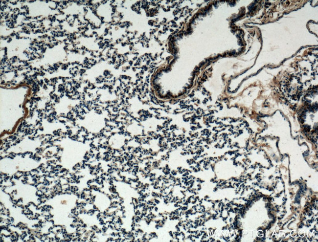 LASS2 Antibody in Immunohistochemistry (Paraffin) (IHC (P))