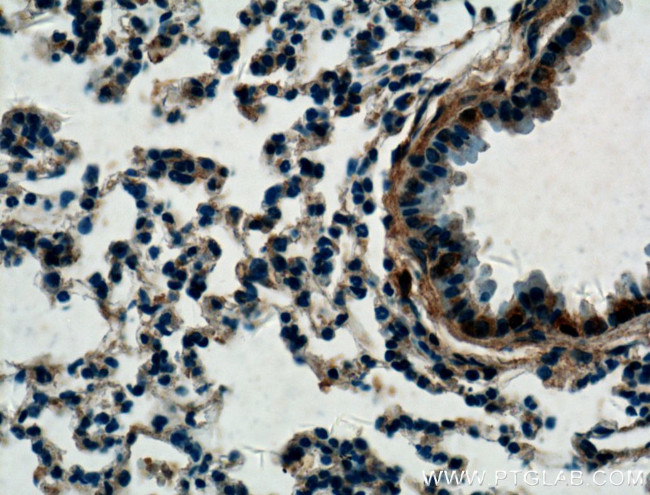 LASS2 Antibody in Immunohistochemistry (Paraffin) (IHC (P))