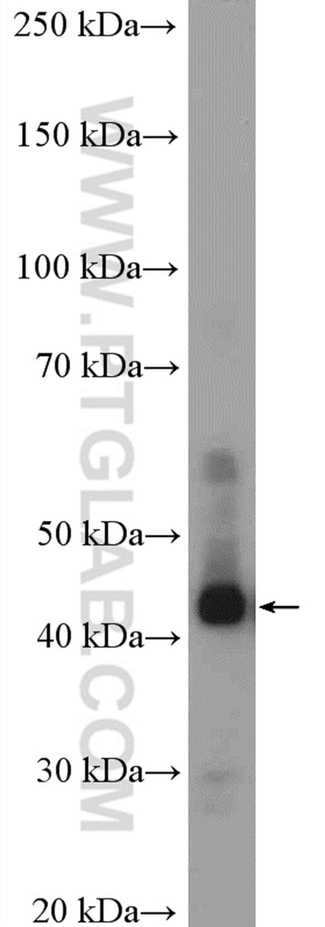 LASS2 Antibody in Western Blot (WB)