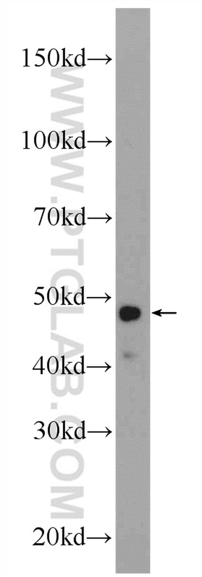 LASS2 Antibody in Western Blot (WB)