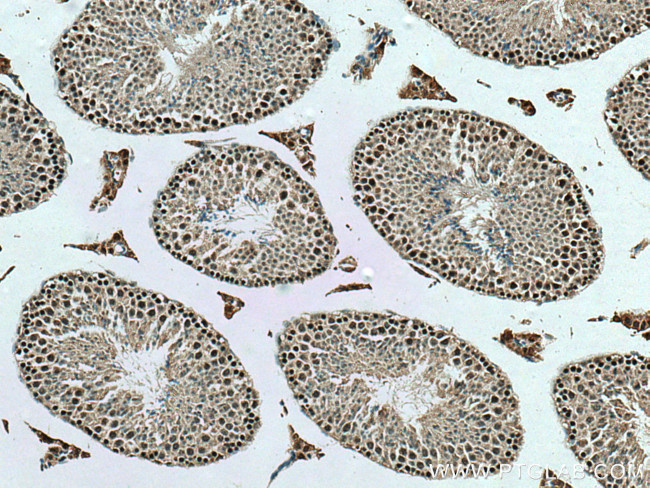 TAF10 Antibody in Immunohistochemistry (Paraffin) (IHC (P))