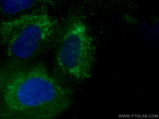 FGD3 Antibody in Immunocytochemistry (ICC/IF)