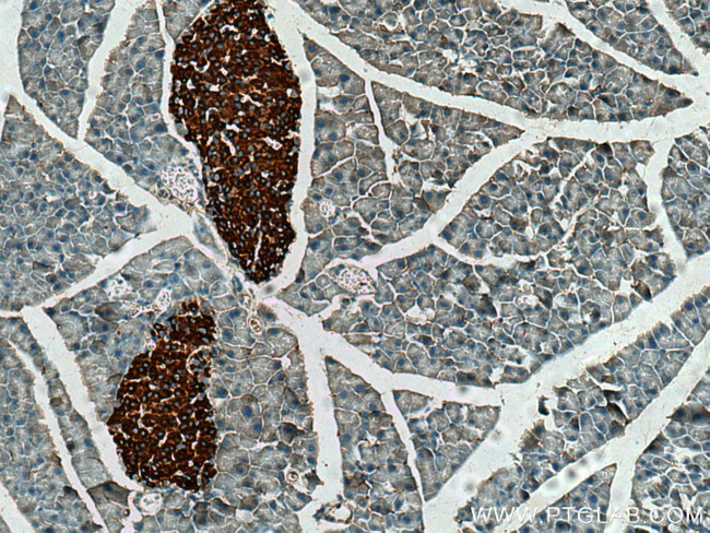 Secretogranin II Antibody in Immunohistochemistry (Paraffin) (IHC (P))