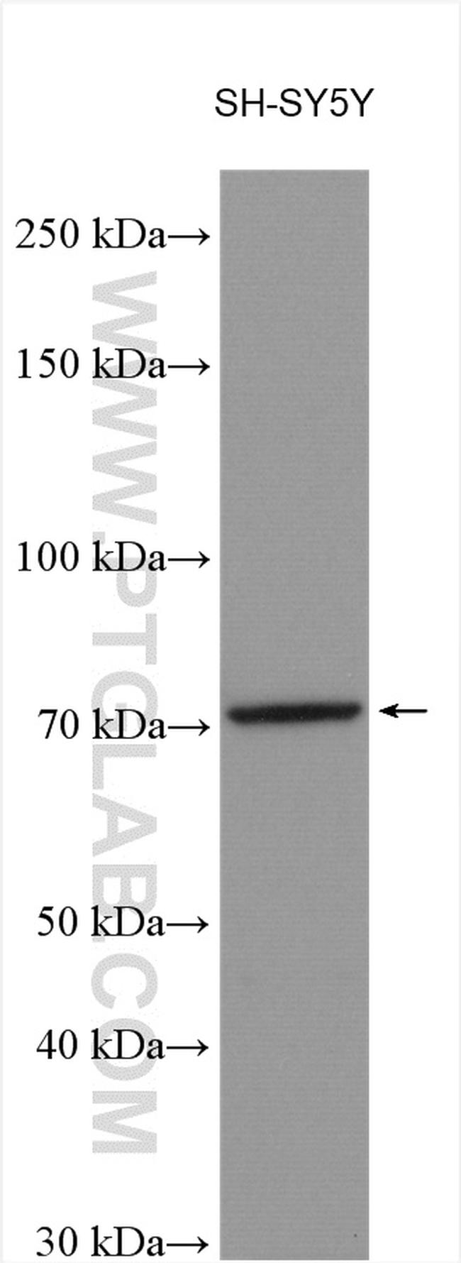 Secretogranin II Antibody in Western Blot (WB)