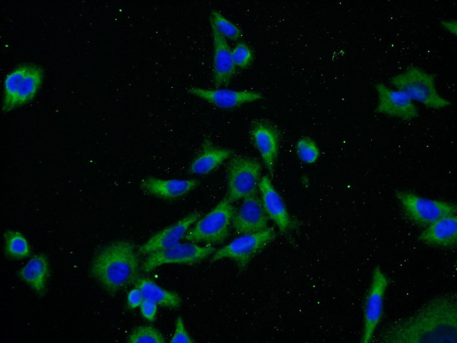 PRKAR1A Antibody in Immunocytochemistry (ICC/IF)